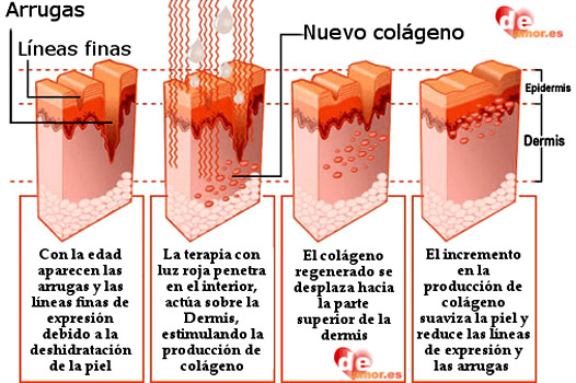 Estetica VZH - Terapia Lumínica Corporal